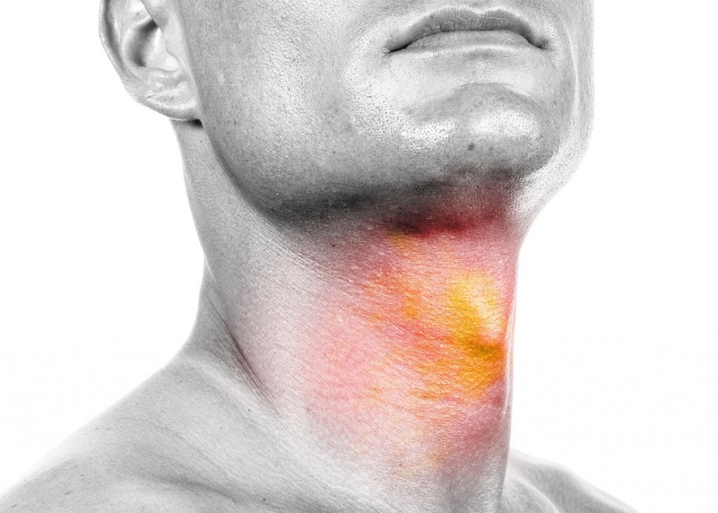 Head-neck-cancer-metroentcare